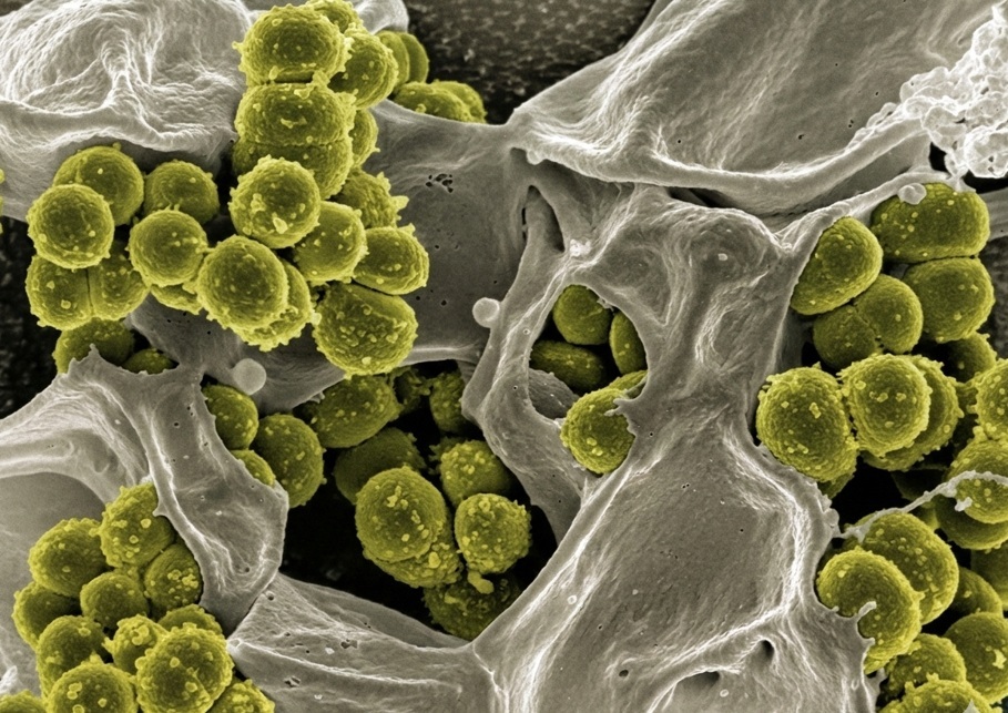 surface interacitons