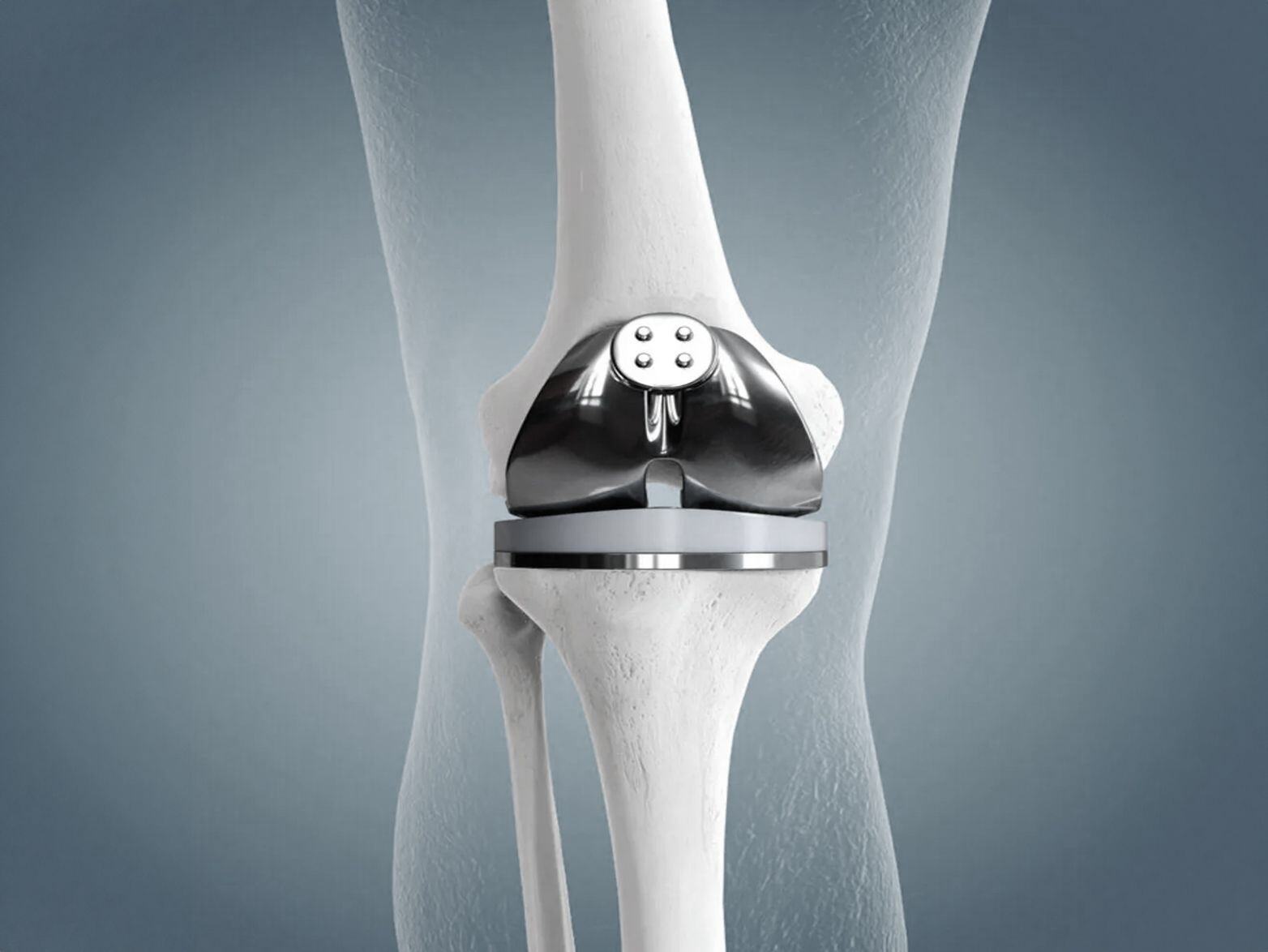 next-gen-tech-for-diagnosing-complicated-infections