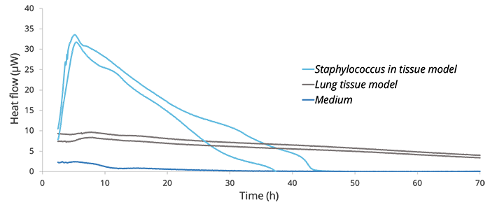 lungmodel lungmodel